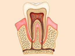 RCT Treatment